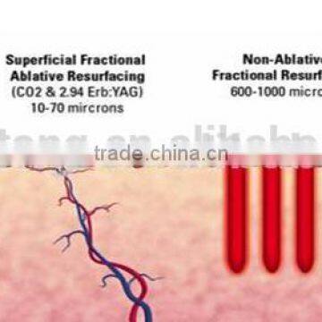 CO2 Fractional Laser Machine 3 In 40w 1 Fractional+ultrapulse+vaginal Tightening Med-870+ Skin Resurfacing photo-5