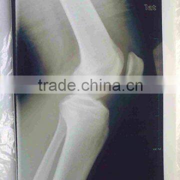 X-ray Film Chemical Medical Polyurethane Film A4 Sheet