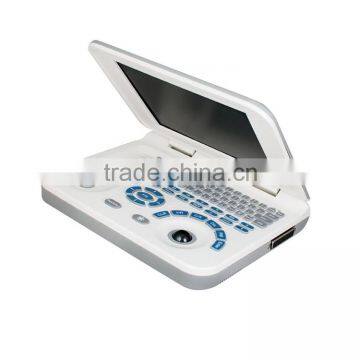 Hot Sale Sony Printer /medical Use Ultrasonic Diagnostic-Large Screen 10.4 Inch Laptop Ultrasound Scanner photo-5