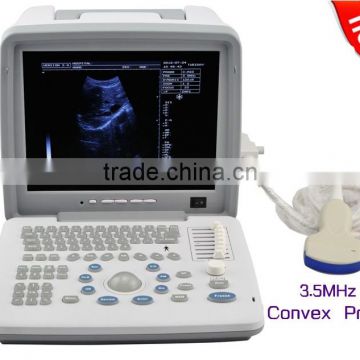 Latest Portable 12 inch monitor Ultrasound Scanner with 80 element convex probe High frequency linear probe