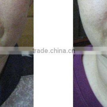 Ultrasound Therapy Hifu Facelift Wrinkle Skin Tightening Removal Spa Use Machine Portable photo-4