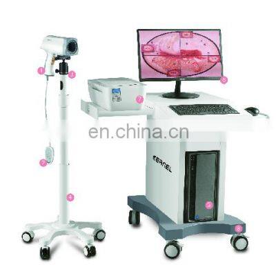 CE certificate High quality Digital Optical Video Vagina Colposcope  For Gynecology