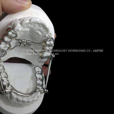 Orthodontic-Appliance China Dental Laboratory - Outsourcing Dental Lab photo-2