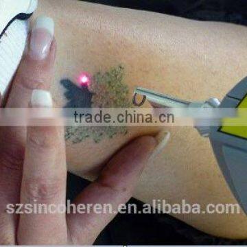 HOT Sell Sincoheren Nd:yag Laser Tattoo Removal Q-switch Skin Rejevenation. photo-4