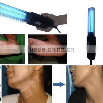 UVB therapy lamp---311nm Psoriasis hand held lamp