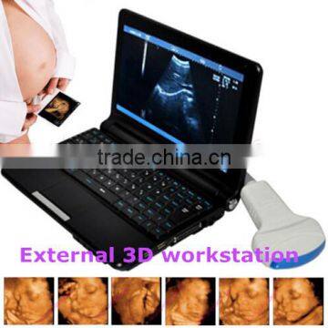 Laptop Ultrasound scanner Diagnostic machine + Convex Probe +external 3D workstation optional