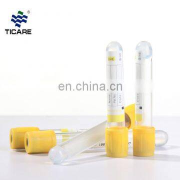 High Quality Plain Vacuum Blood Collection Tube photo-2