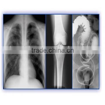 2015 best price fuji agfa medical x-ray medical film for hospitals medical device