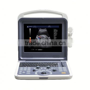 2016 beautiful 3d/4d ultrasound color doppler scanner with fetus