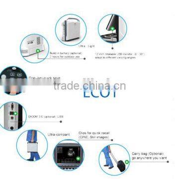 Promotion!!CE Approved Notebook/ Portable Chison USB Ultrasound Scanner With 3.5Mhz Multi-frequency Convex Probe ECO1 photo-2