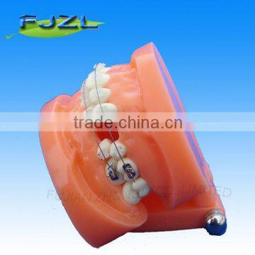 Dental orthodontic implant study plastic dental model of teeth