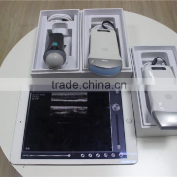 High quality wireless ultrasound scanner