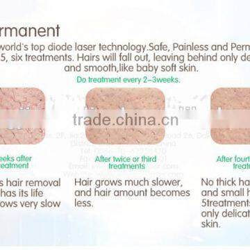 808nm Diode Laser Fast Permanent Hair Removal Machine/diode Laser Device Portable photo-5