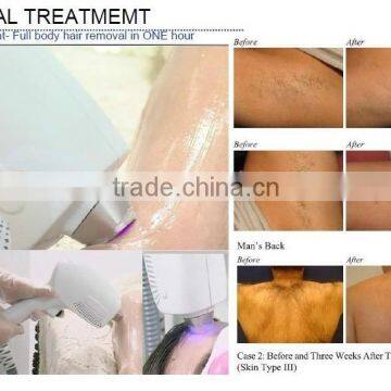 Wholesale Diode Laser Portable Hair Removal Beauty Machine photo-6
