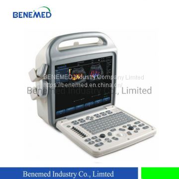 Popular Portable Color Doppler Ultrasound Scanner Medical Equipment