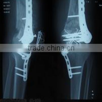 digital film medical, thermal x-ray film, film xray