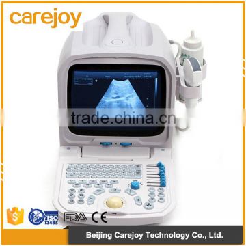 Beautiful compact diagnostic ultrasound probe / mini ultrasound machine / Portable ultrasound scanner