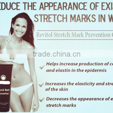 Stretch Mark Prevention Lotion