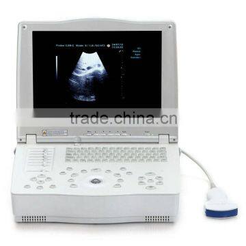 New Laptop Ultrasound Scanner for Abdominal, Cardiology, Gynecology, Obstetrics and Urology photo-2