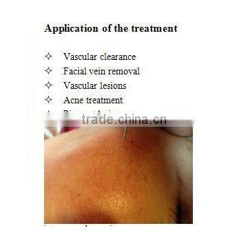 Last Price Portable Spider Vein Red Blood Vessels Removal Machine photo-5