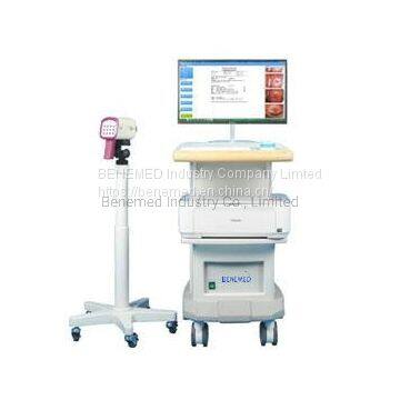 Medical Equipment Digital Video Colposcope for Gynecology