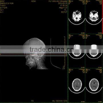 Medical endoscope room film