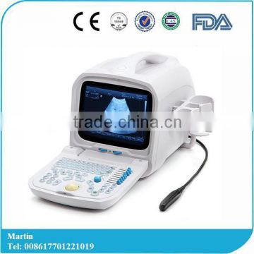 2016 Hot Sale Portable Ultrasonic Diagnostic Devices Type B Ultrasound-RUS-9000A