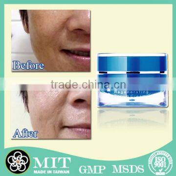 High effect acne scar removal of skin bleaching freckle cream