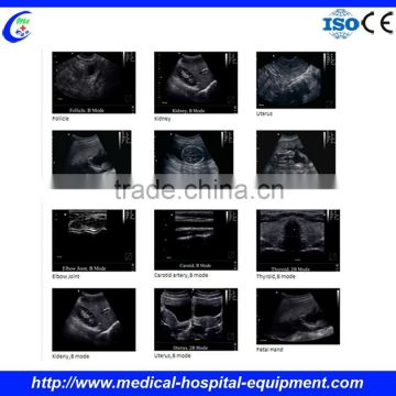 Ultrasound Machine for Pregnancy