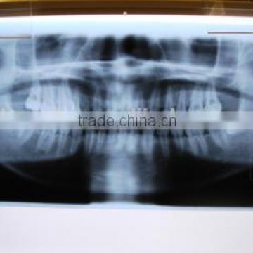 medical x-ray film for panoramic dental x-ray machine, x-ray blue film