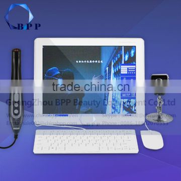 Galactophore Analyzer For Breast Clinic Beauty Machine