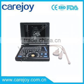 Promotion!!CE approved Laptop Ultrasound Scanner with 3.5Mhz multi-frequency convex probe RUS-9000E2