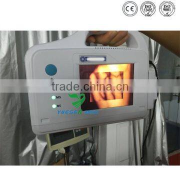 YSVV200 Guanghzou Hot Vein Illumination Device Price photo-5