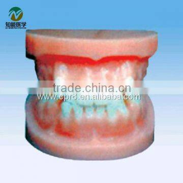 BIX - L1025 Orthodontic model