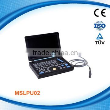 Full Digital laptop ultrasound machine MSLPU02-M