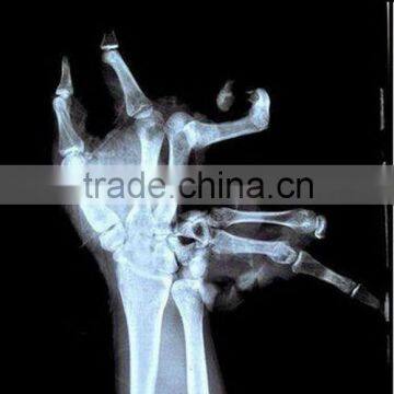 Fuji imagers konida agfa drystar films dry laser medical x-ray film processing machine