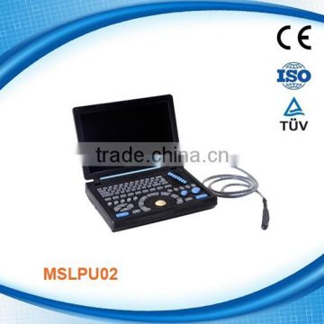 Laptop digital diagnostic ultrasound with CE and ISO MSLPU02P