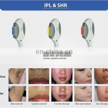 Powerful Germany Xenon Lamp SHR Laser Hair Removal Machine for Sale photo-3