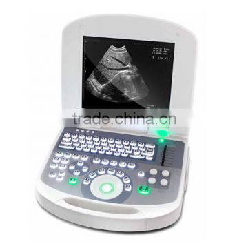 Laptop Ultrasound Scanner RUS-2200 type B ultrasonic for sale