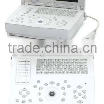 Hospital Clinical Equipment 15-inch Full Digital Laptop Ultrasound Scanner China Made Portable Ultrasound Machine photo-5