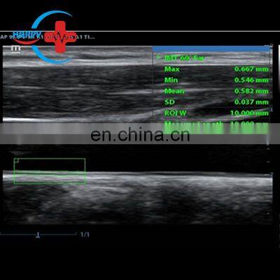 Mindray DC-30 Ultrasound Equipment/Mindray Color Doppler Ultrasound photo-4