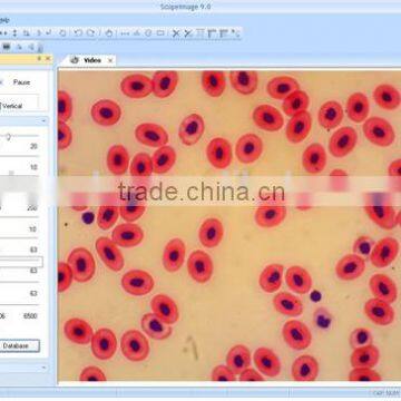 Microscopic Analysis Software ScopeImage-9.0 image processing software