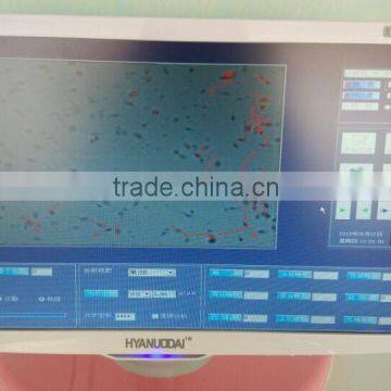 Best New Cheap Sperm Analysis System for the Hospital photo-6