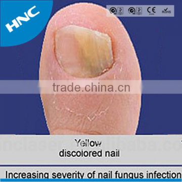 New invented 2015 Nail Fungus laser treatment clip