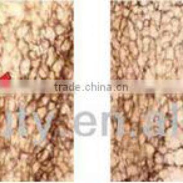 Sanhe SU-5 Faster Fat Freeze Body Shaping Cavitation Slimming System photo-6