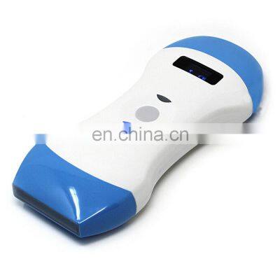 CE Certificated Portable 128 Elements 3 In 1 Wireless Ultrasound Machine for Hospital Use
