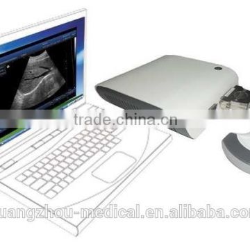 MCU-UBox-10 Digital 3D B Scanner Ultrasound Box