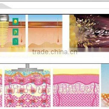 NL- RUV500 Cavitation Tripolar Multipolar Bipolar rf Machine/liposlim Cavitation Machine /gel for Cavitation Machine photo-6