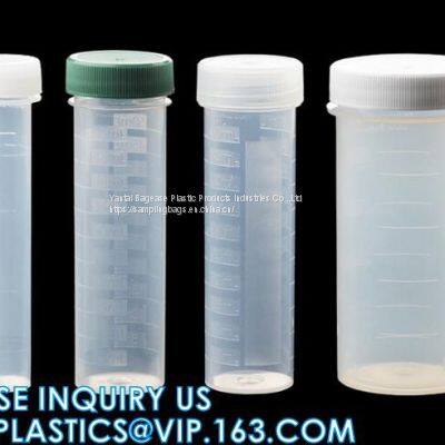 Medical 10ml Plastic Sampling Collection Tube Disposable Vacuum Blood Collection Tube, Factory Price Plastic 10ml 20ml Medical Vacuum Blood Sampling Collection Tube photo-2