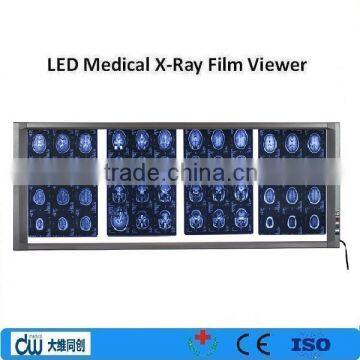 High Brightness X Ray Film Viewer or Negatoscope photo-4
